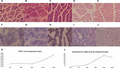 RNA-Seq Analysis Reveals Hub Genes Involved in Chicken Intramuscular Fat and Abdominal Fat Deposition During Development